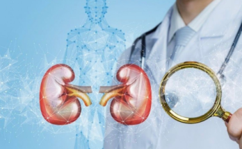 Diabetes and Kidney Problems An In-Depth Exploration