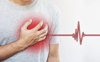 Understanding Heart Problems
