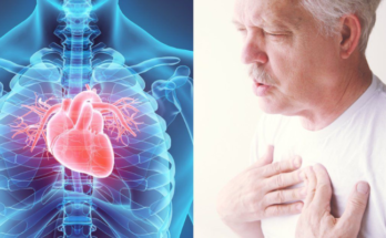 Understanding the Causes of Heart Disease
