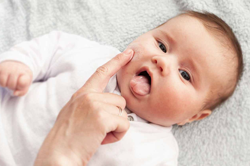  Child showing symptoms of a food allergy, holding a swollen face with worried parents nearby